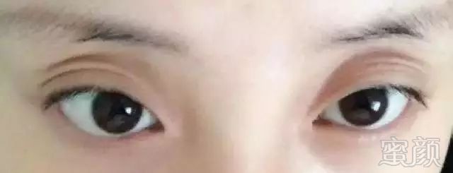 https://img.miyanlife.com/mnt/timg/180225/103A53G5-5.jpg