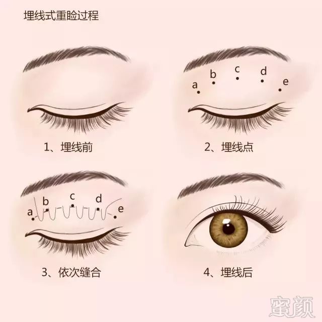 https://img.miyanlife.com/mnt/timg/180225/103QWG7-3.jpg