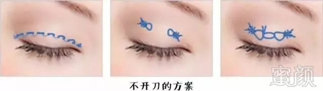 https://img.miyanlife.com/mnt/timg/180225/1045323P0-0.jpg