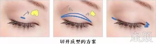 https://img.miyanlife.com/mnt/timg/180225/104532MV-2.jpg