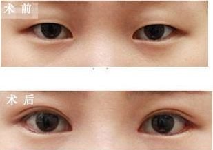 https://img.miyanlife.com/mnt/timg/180225/11000Q938-9.jpg