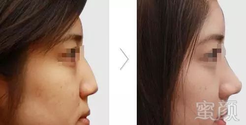 https://img.miyanlife.com/mnt/timg/180225/110J42121-14.jpg