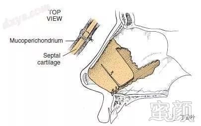 https://img.miyanlife.com/mnt/timg/180226/1115505622-4.jpg
