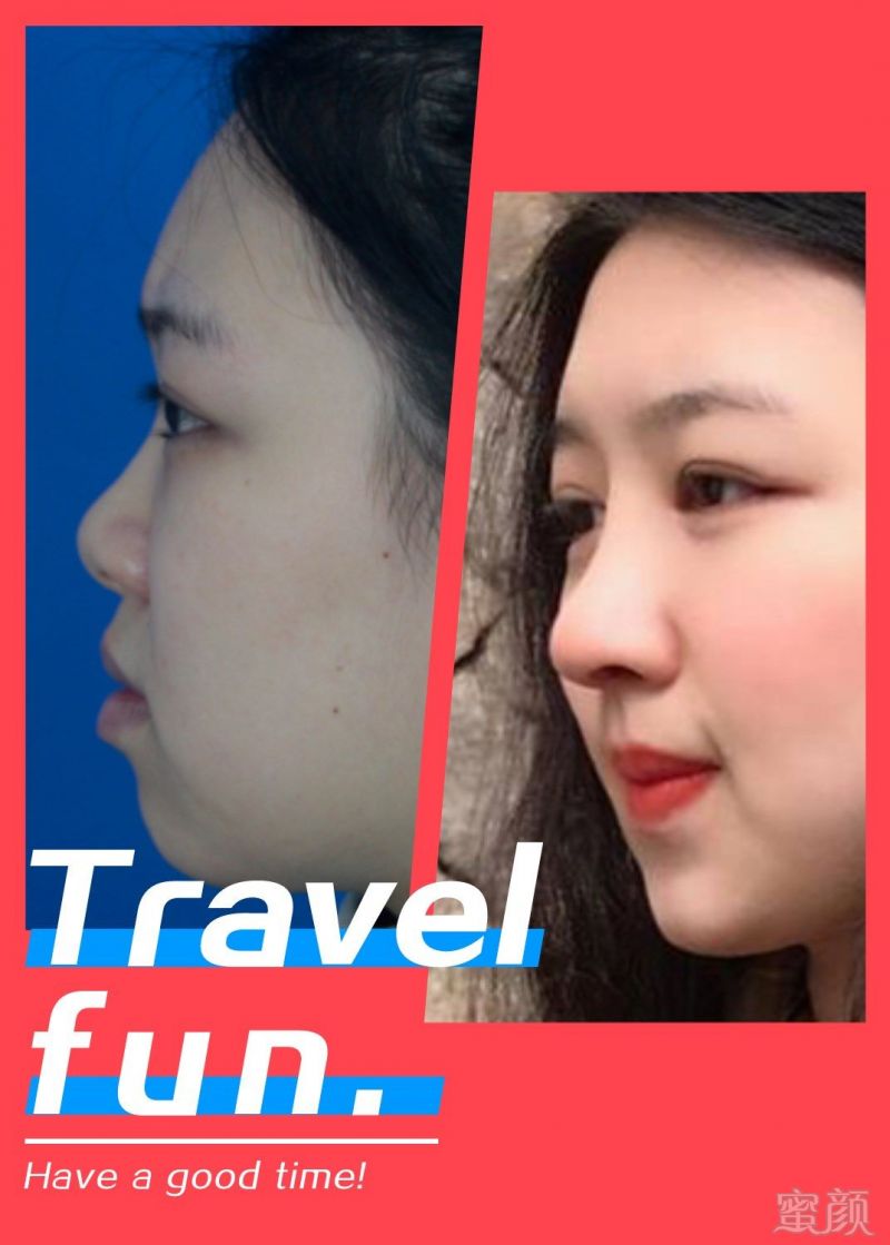 https://img.miyanlife.com/mnt/timg/180226/112PV536-1.jpg