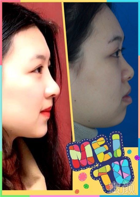 https://img.miyanlife.com/mnt/timg/180226/112Pa105-4.jpg