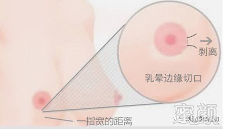 https://img.miyanlife.com/mnt/timg/180226/11321I4B-2.jpg