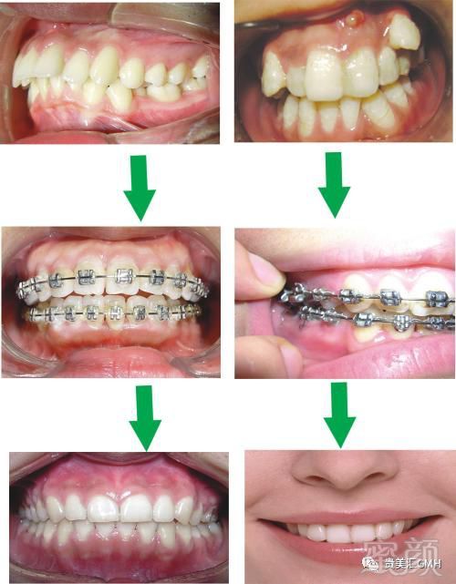 https://img.miyanlife.com/mnt/timg/180226/113Z23445-0.jpg