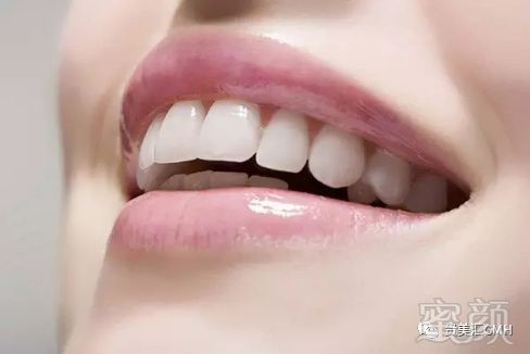 https://img.miyanlife.com/mnt/timg/180226/113Z33B2-3.jpg