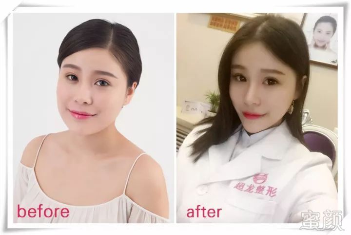 https://img.miyanlife.com/mnt/timg/180226/11402GM5-9.jpg