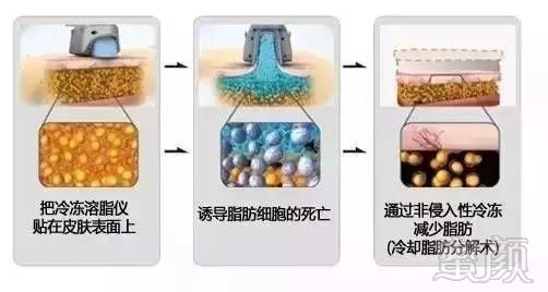 https://img.miyanlife.com/mnt/timg/180226/11402T127-12.jpg