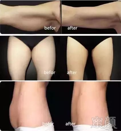 https://img.miyanlife.com/mnt/timg/180226/11402TA0-14.jpg