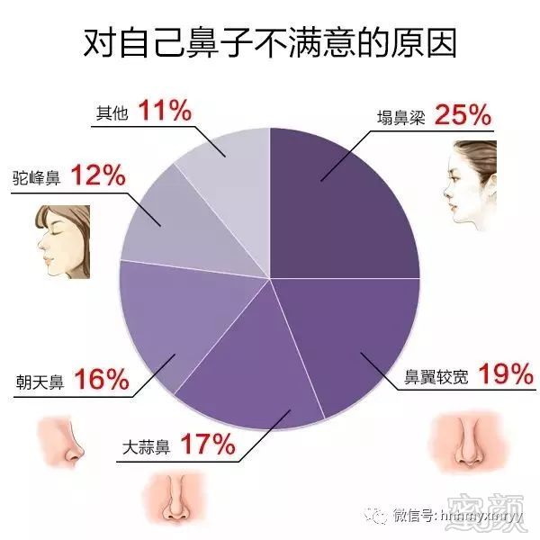 https://img.miyanlife.com/mnt/timg/180226/12015IL5-1.jpg