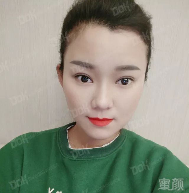 https://img.miyanlife.com/mnt/timg/180226/1204532142-2.jpg
