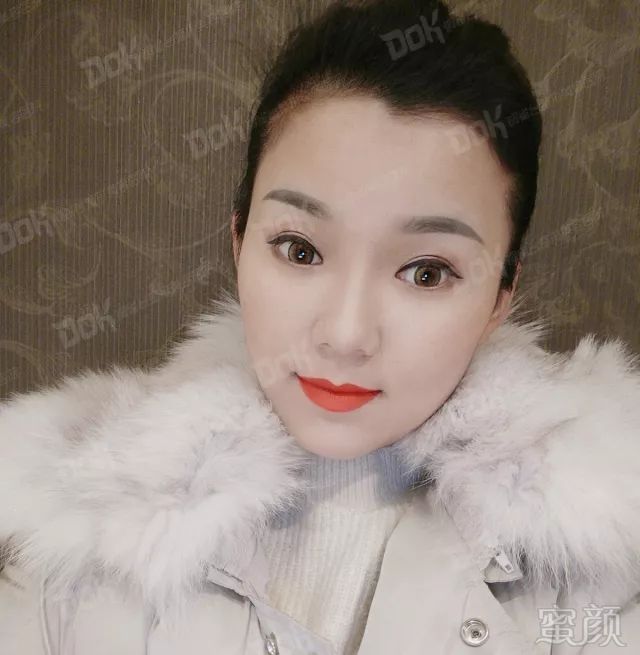 https://img.miyanlife.com/mnt/timg/180226/1204544I1-3.jpg
