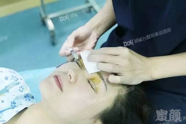 https://img.miyanlife.com/mnt/timg/180226/1204555A1-7.jpg