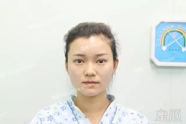 https://img.miyanlife.com/mnt/timg/180226/12045C636-10.jpg