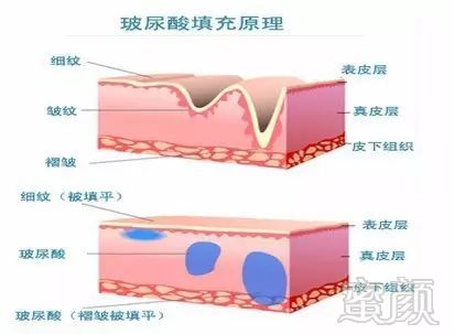 案例图片