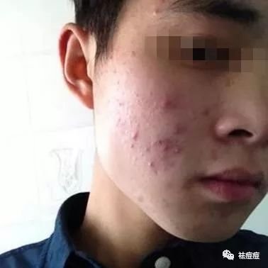 https://img.miyanlife.com/mnt/timg/180226/12104VO0-1.jpg
