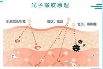 https://img.miyanlife.com/mnt/timg/180226/12124Q543-10.jpg