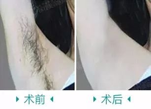 https://img.miyanlife.com/mnt/timg/180226/125551G14-5.jpg