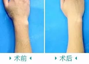 https://img.miyanlife.com/mnt/timg/180226/1255522638-6.jpg