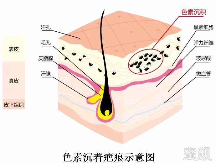 案例图片