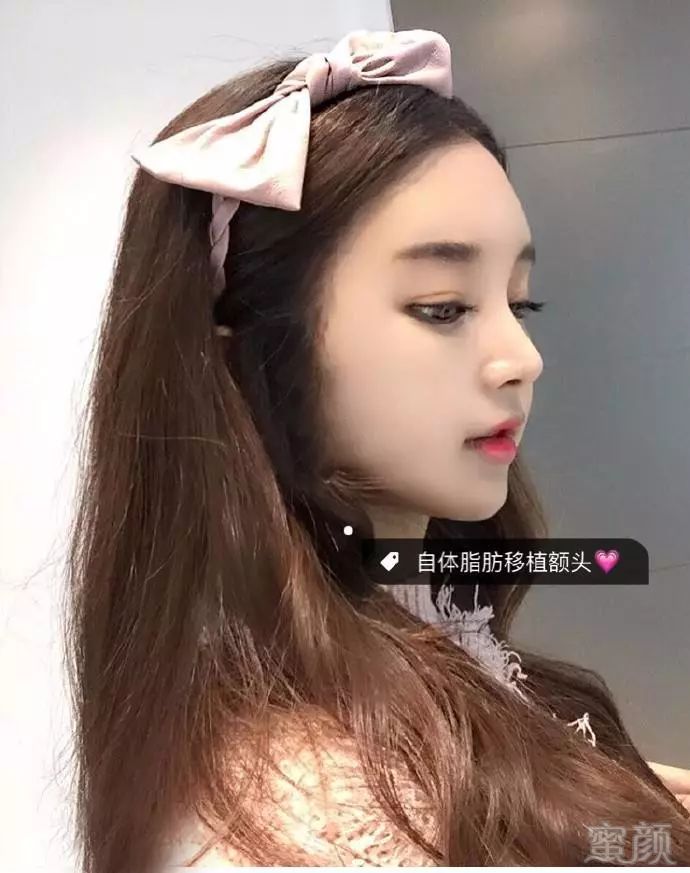 https://img.miyanlife.com/mnt/timg/180226/13140345R-5.jpg