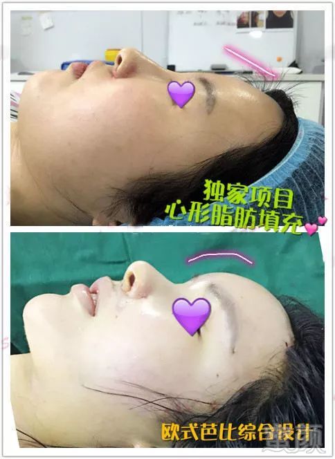 https://img.miyanlife.com/mnt/timg/180226/1314114316-13.jpg