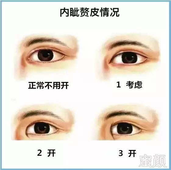https://img.miyanlife.com/mnt/timg/180227/1052164091-7.jpg