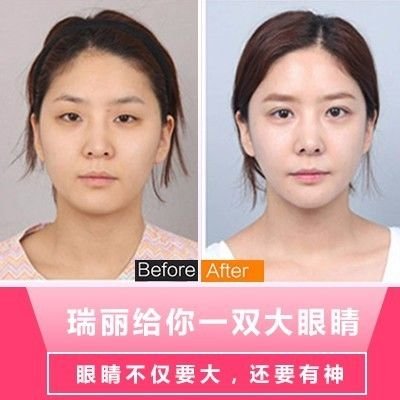 https://img.miyanlife.com/mnt/timg/180227/1052204428-11.jpg