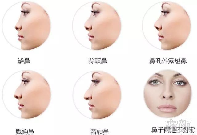 https://img.miyanlife.com/mnt/timg/180227/1053154632-7.jpg