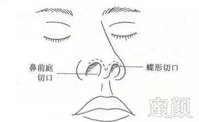 https://img.miyanlife.com/mnt/timg/180227/10531560F-10.jpg