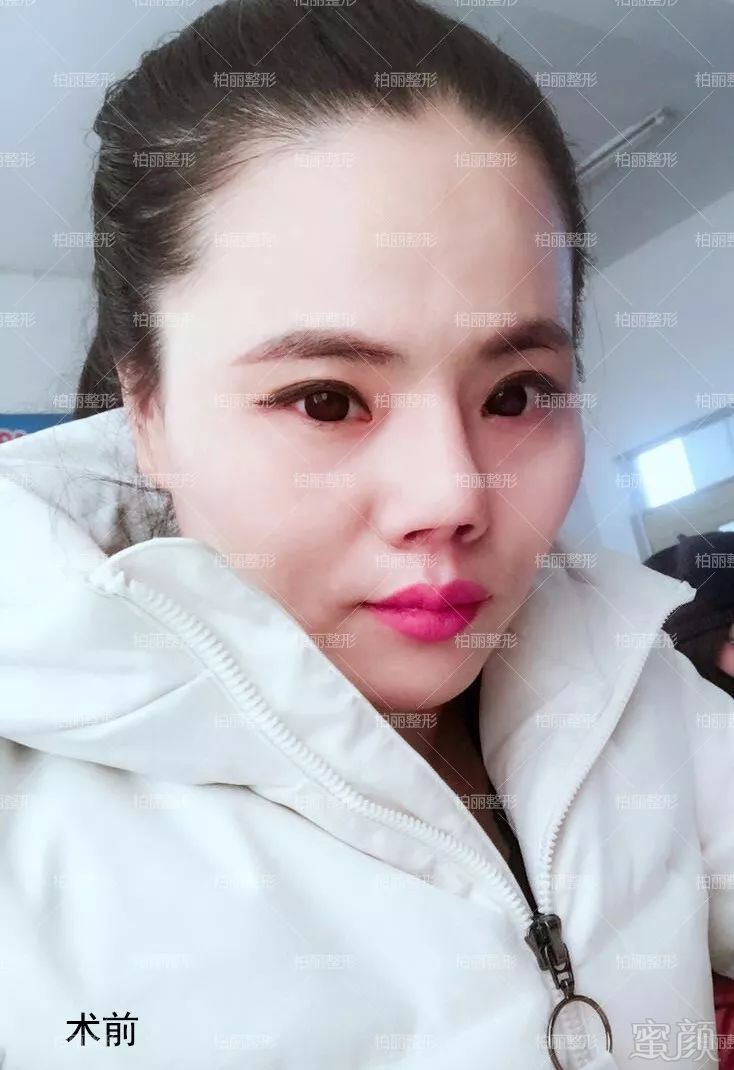 https://img.miyanlife.com/mnt/timg/180227/1054392410-2.jpg