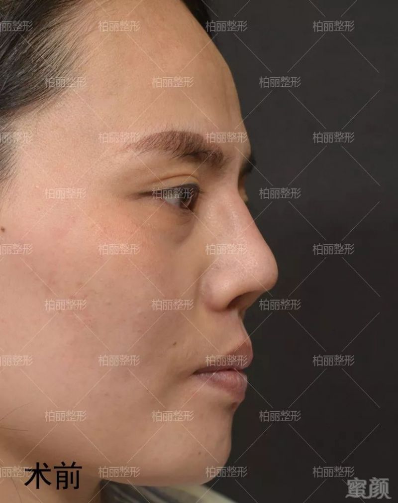 https://img.miyanlife.com/mnt/timg/180227/1054394H6-1.jpg