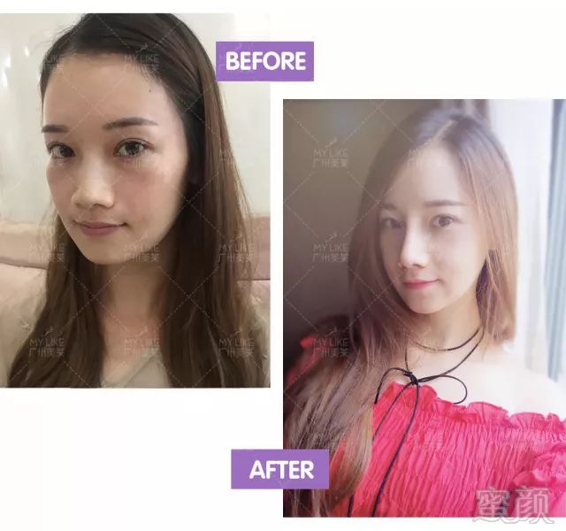 https://img.miyanlife.com/mnt/timg/180227/1059513b0-4.jpg