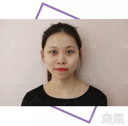 https://img.miyanlife.com/mnt/timg/180227/10595163I-1.jpg