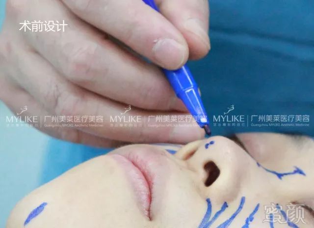 https://img.miyanlife.com/mnt/timg/180227/1059521912-5.jpg