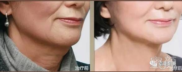 https://img.miyanlife.com/mnt/timg/180227/105ZQ5c-12.jpg