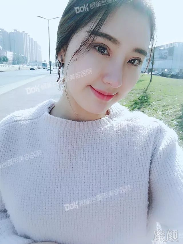 https://img.miyanlife.com/mnt/timg/180227/110225La-0.jpg