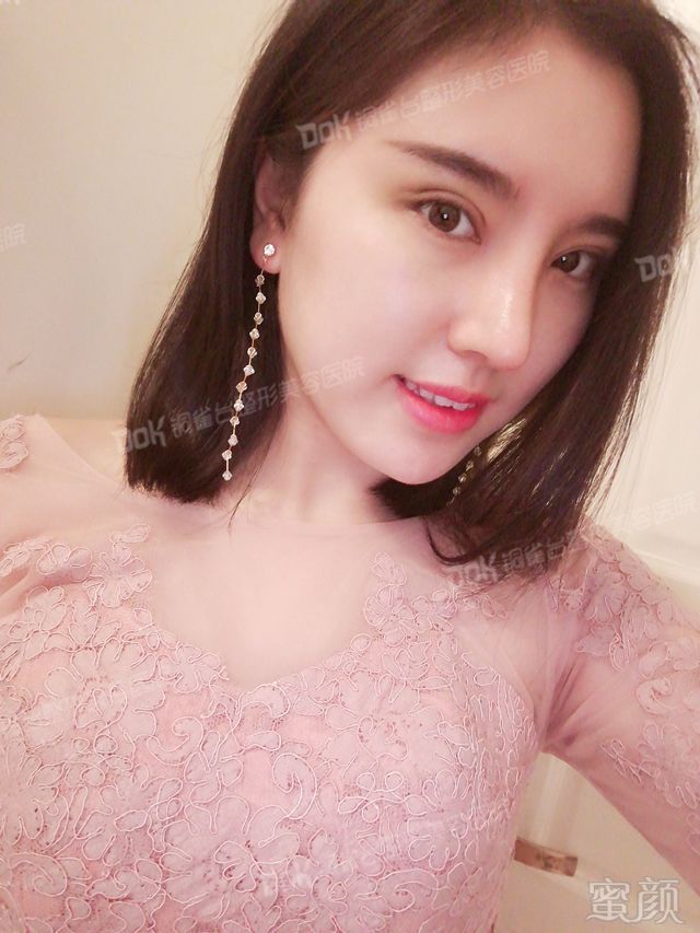 https://img.miyanlife.com/mnt/timg/180227/1102262411-6.jpg