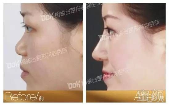 https://img.miyanlife.com/mnt/timg/180227/11022QC4-14.jpg
