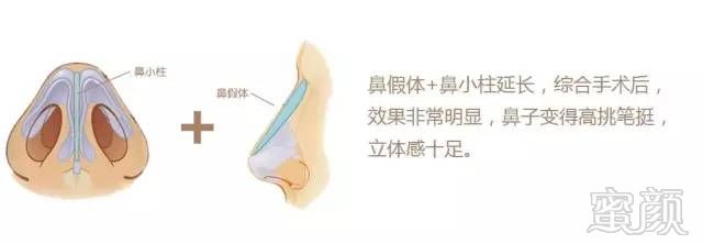 https://img.miyanlife.com/mnt/timg/180227/11022W948-13.jpg