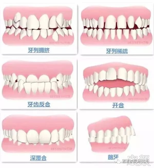 https://img.miyanlife.com/mnt/timg/180227/112I32158-1.jpg