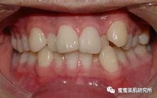 https://img.miyanlife.com/mnt/timg/180227/112IC5Z-4.jpg