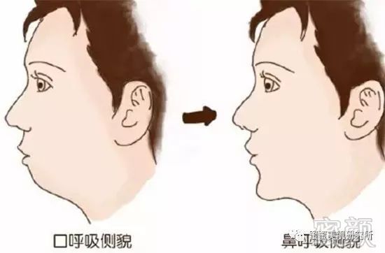 https://img.miyanlife.com/mnt/timg/180227/112IM223-6.jpg