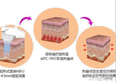 案例图片