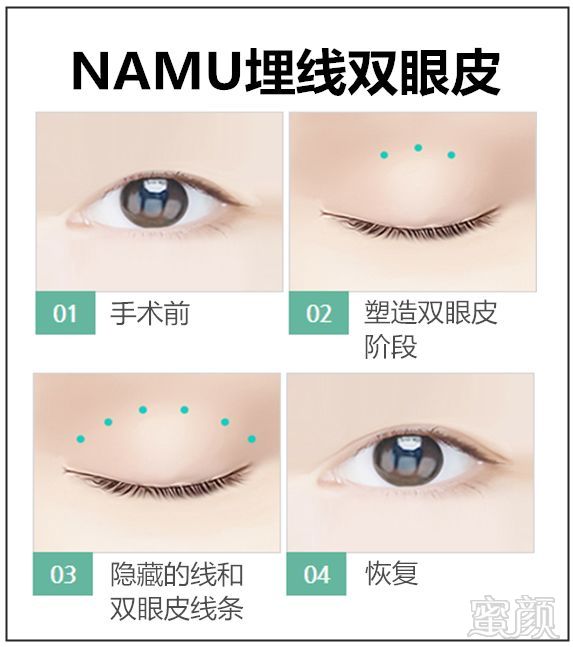 https://img.miyanlife.com/mnt/timg/180227/1131045061-4.jpg