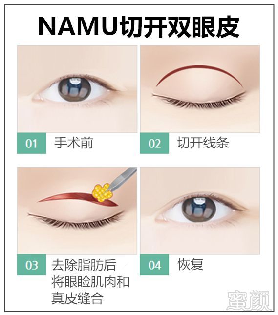 https://img.miyanlife.com/mnt/timg/180227/11310531X-5.jpg