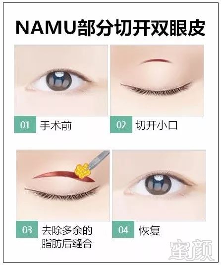 https://img.miyanlife.com/mnt/timg/180227/1131054O6-6.jpg