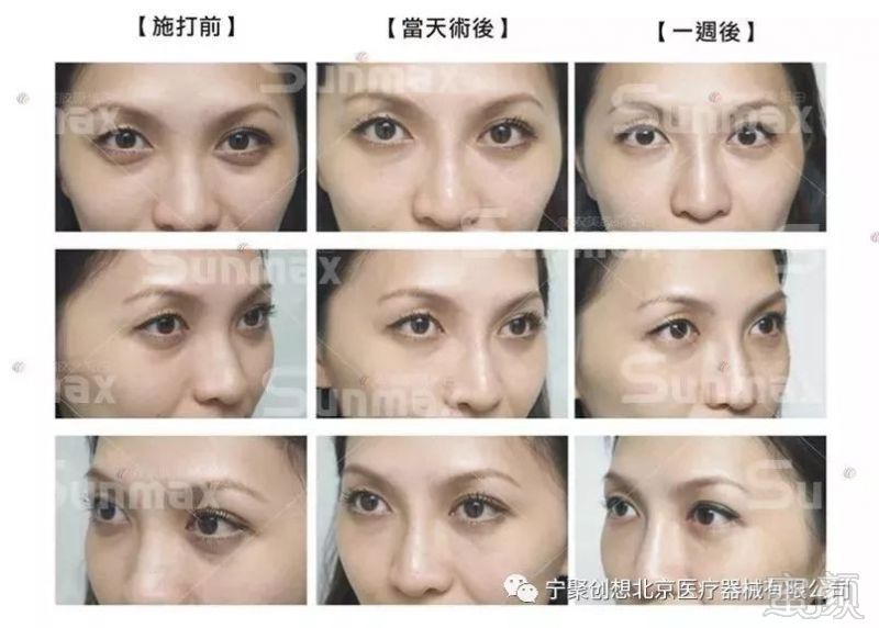 https://img.miyanlife.com/mnt/timg/180227/1144594F3-11.jpg